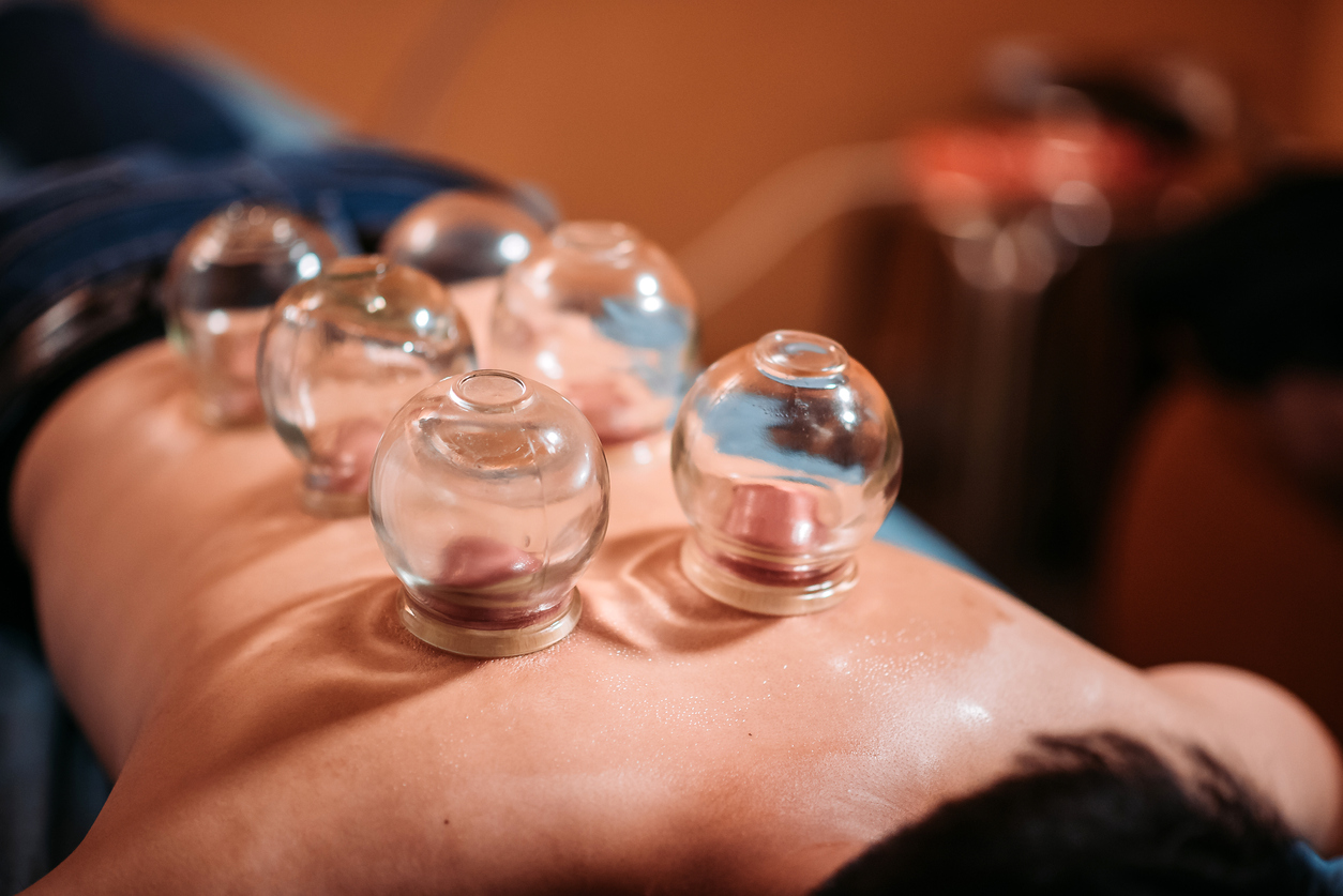 RMT Cupping Therapy Brampton