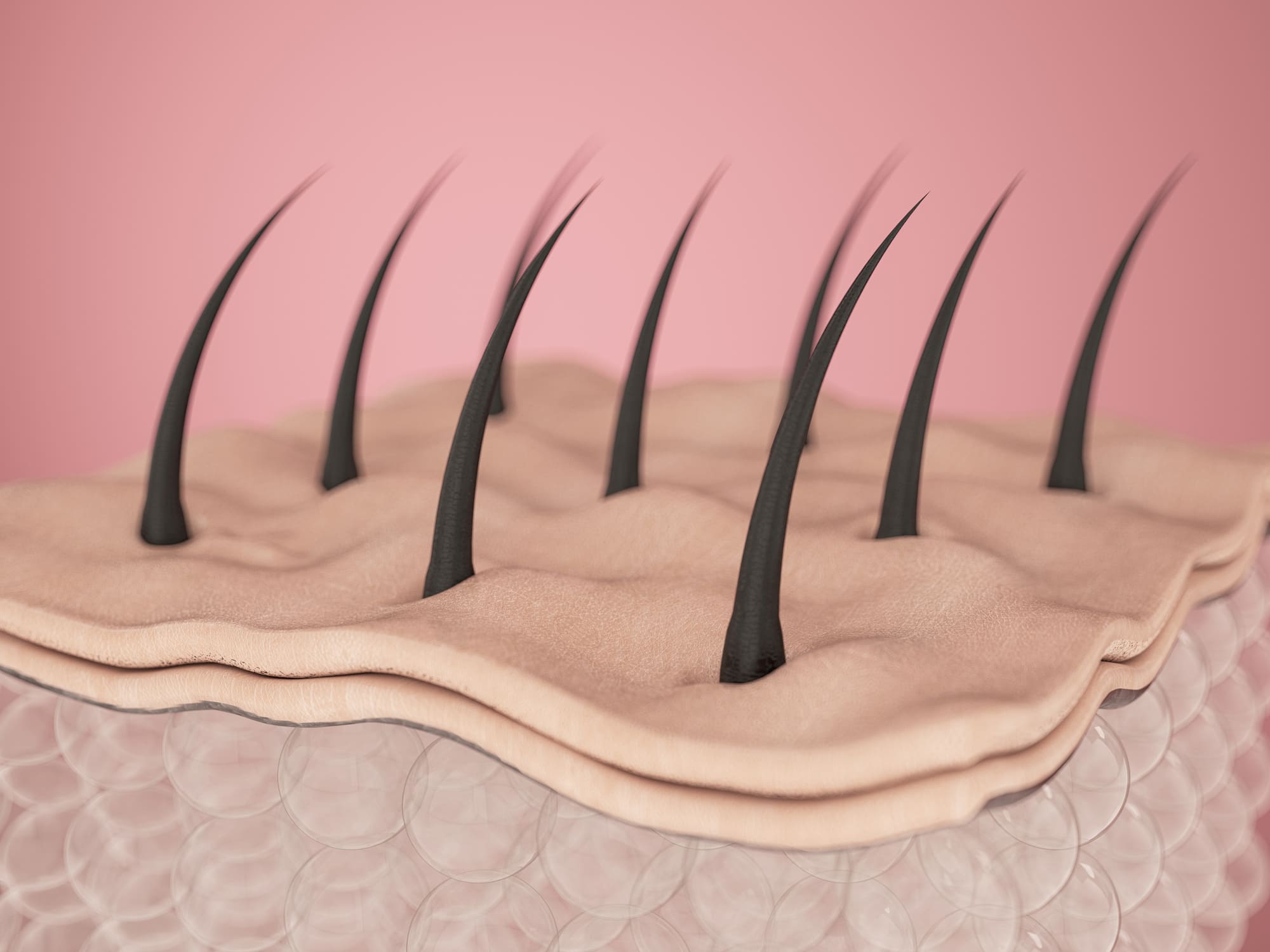 Hair Growth Cycles and Laser Hair Removal