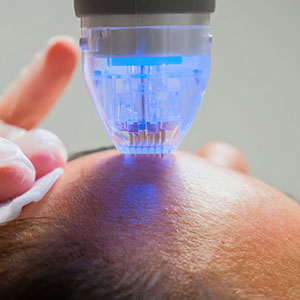 AQUA-PURE-FACIAL-BRAMPTON