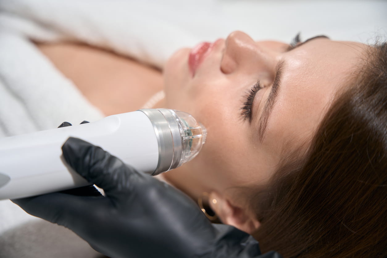 Dermastamp Microneedling 