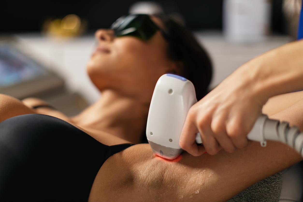 Laser-Hair-Removal-Brampton