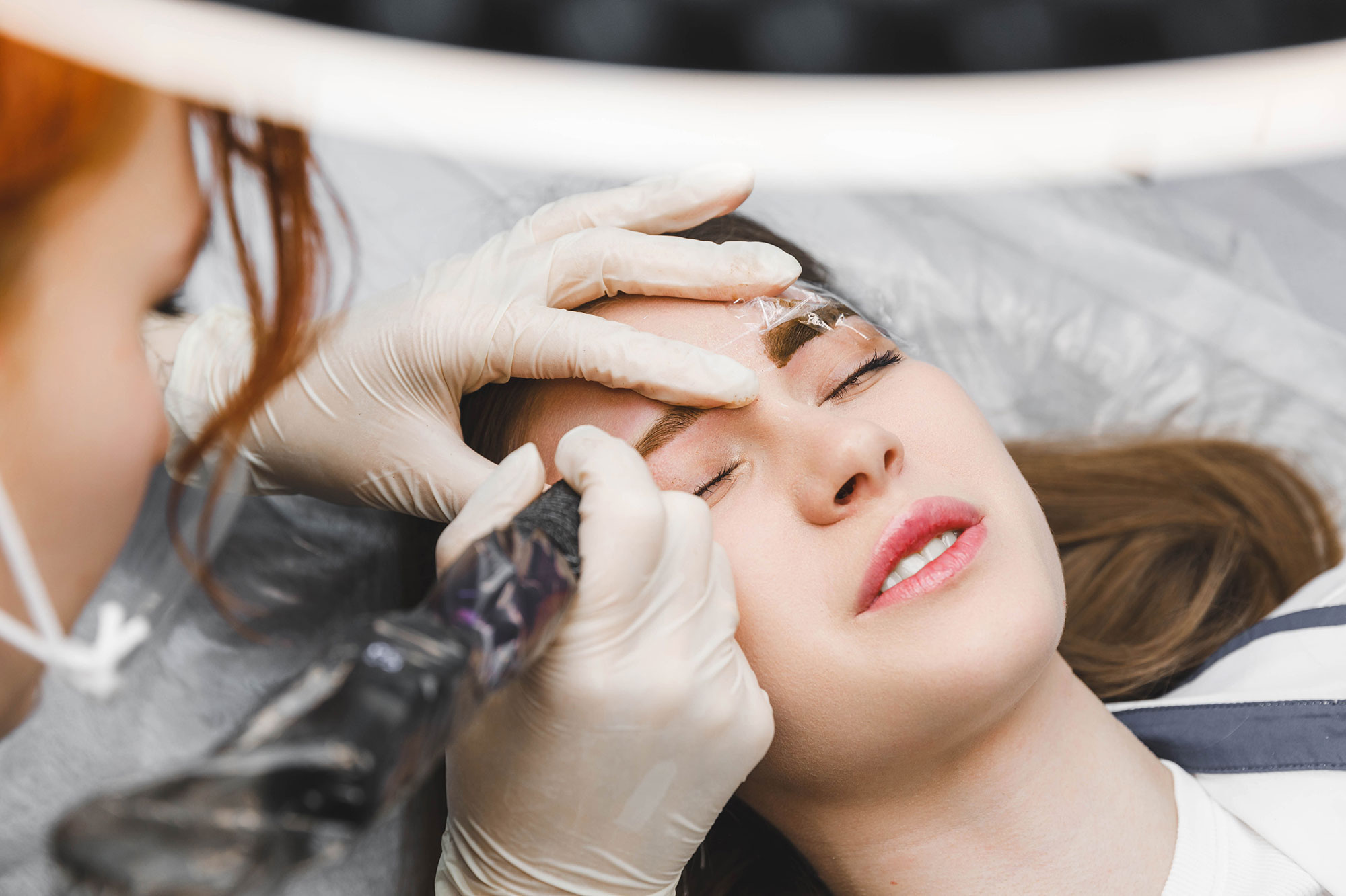 MELASMA PIGMENTATION TREATMENT