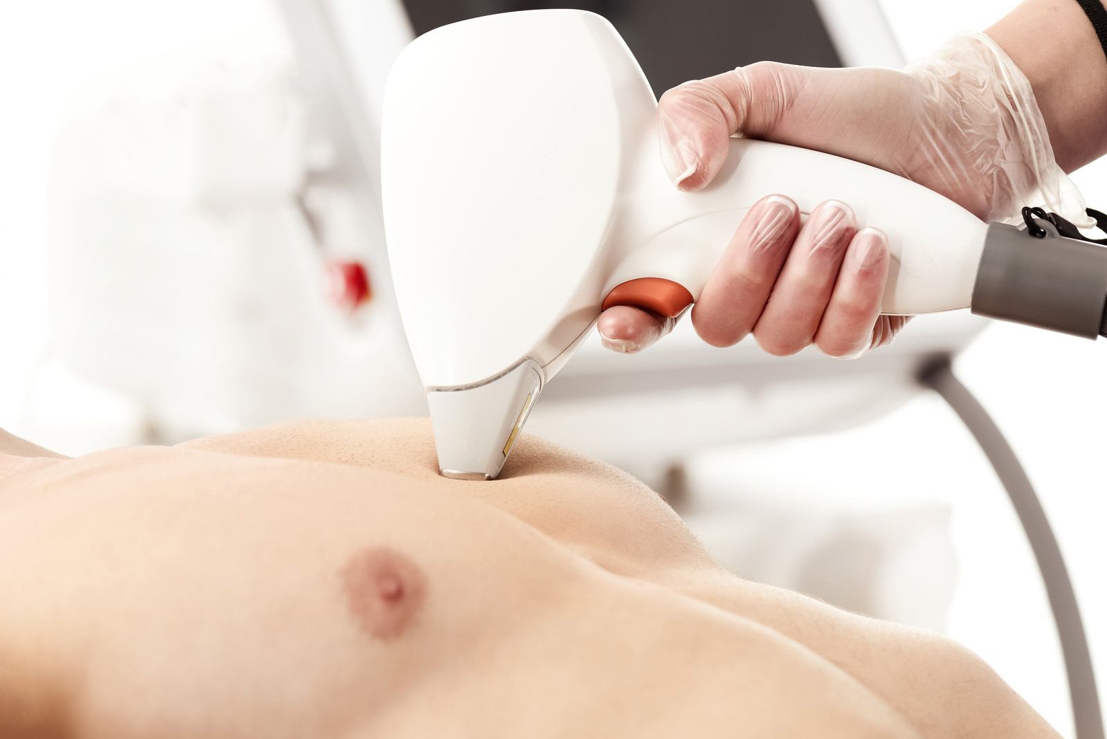 Chest Laser Hair Removal in Brampton