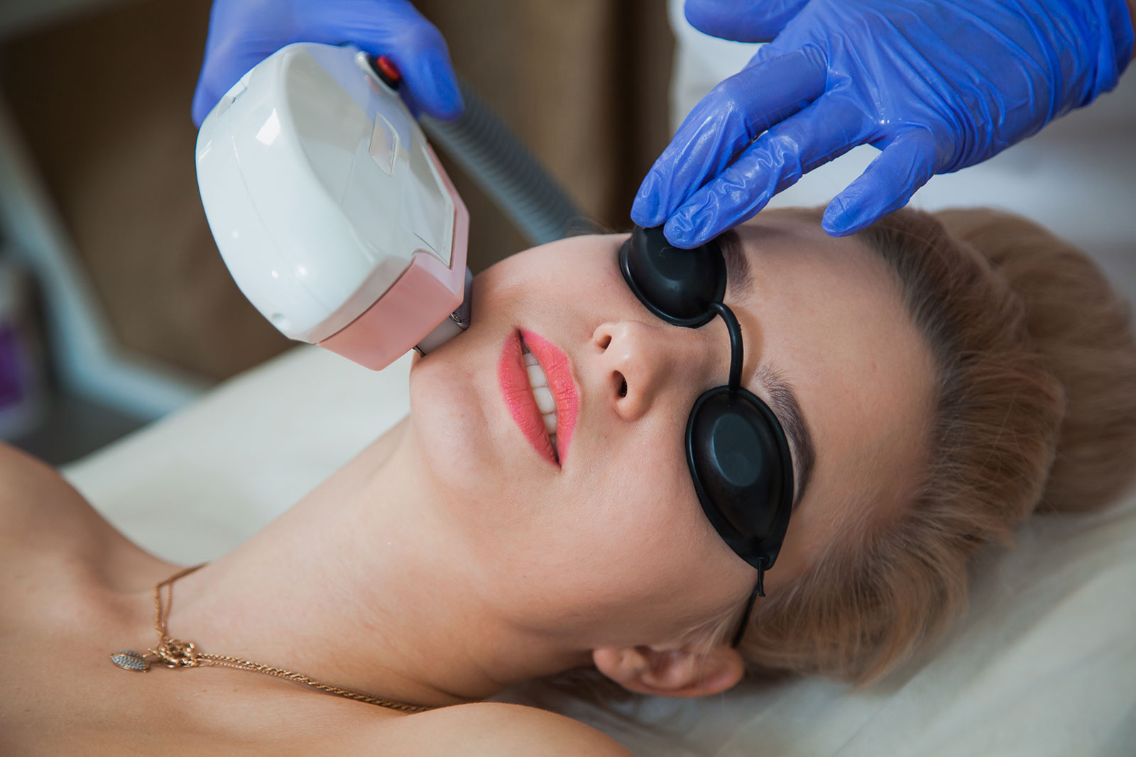 Face Laser Hair Removal in Brampton