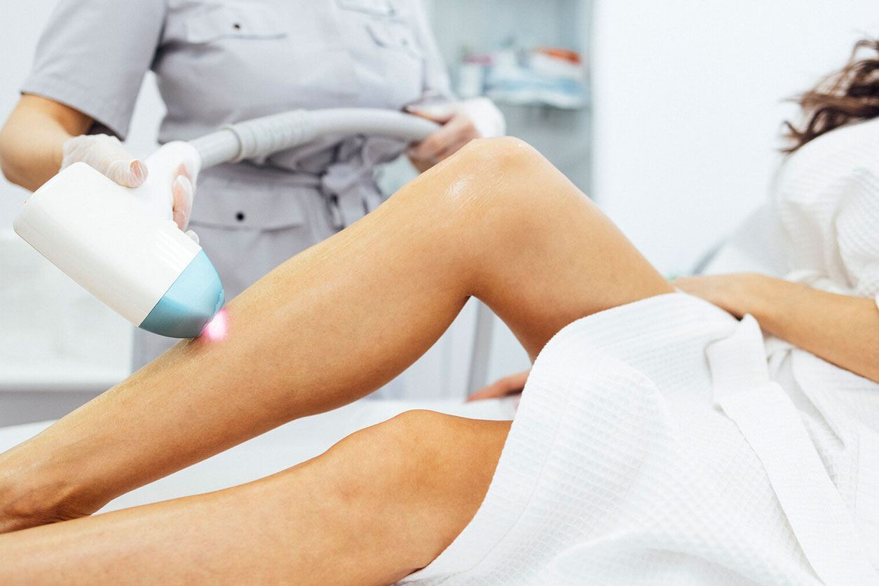 LASER HAIR REMOVAL
