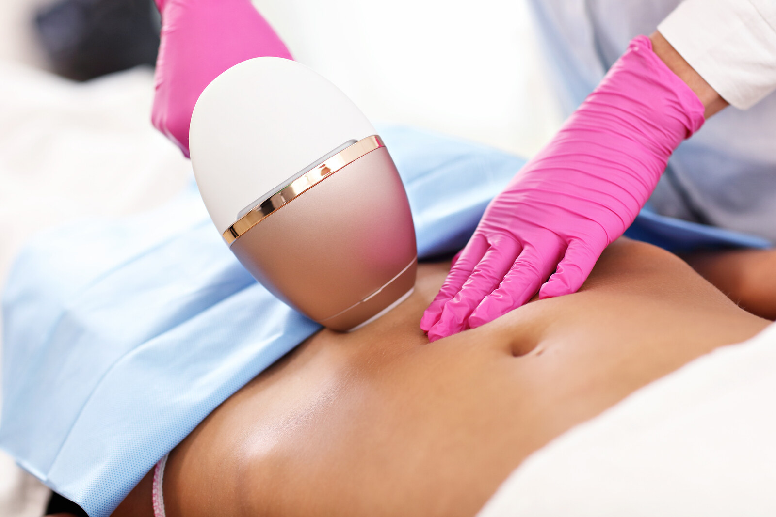 Stomach Laser Hair Removal in Brampton