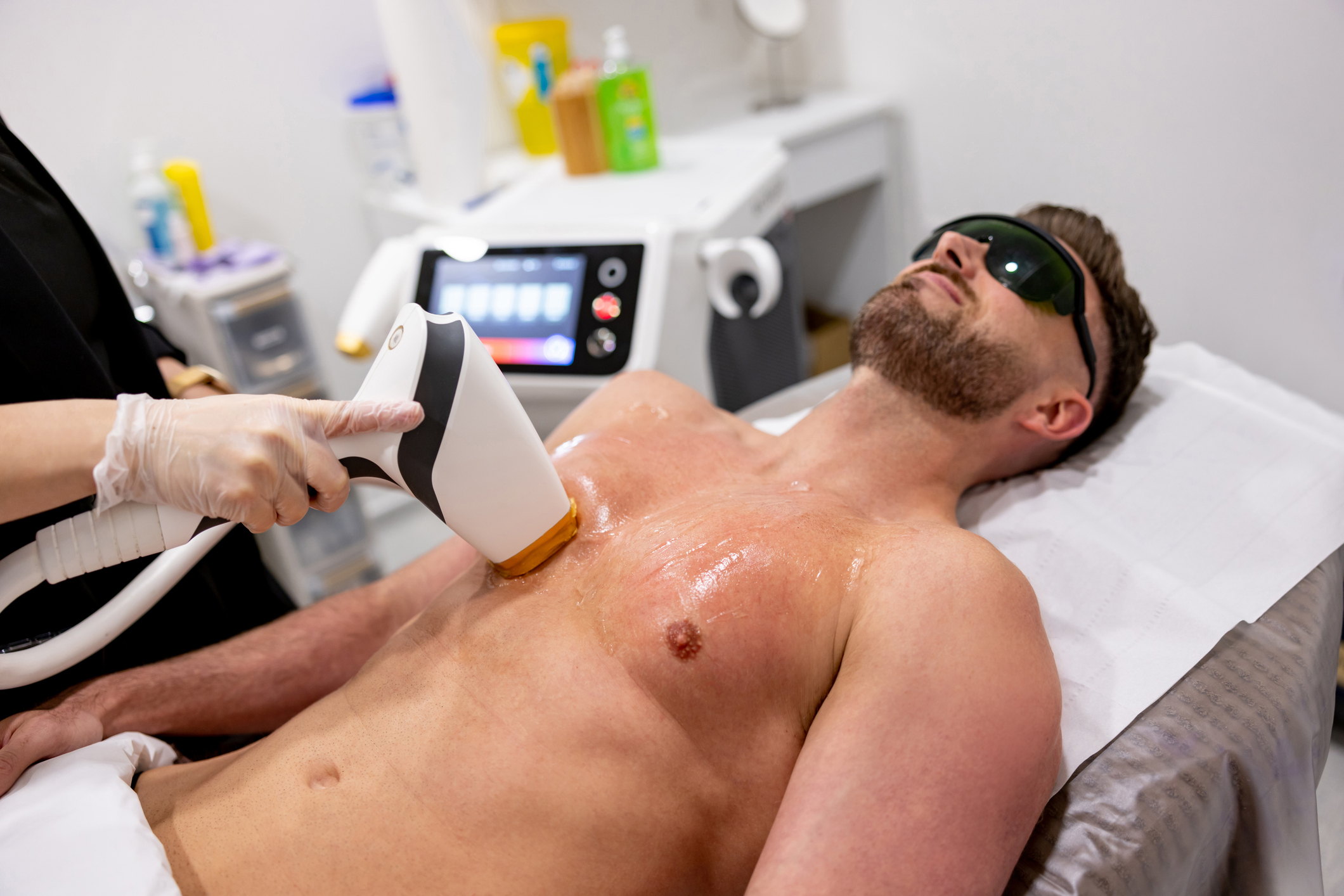 Laser for Men: Taming Thick Hair and Managing Folliculitis<br />
